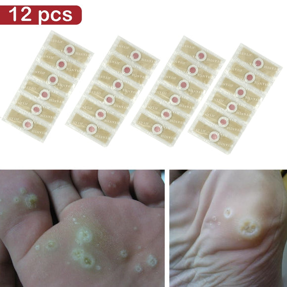 12PCS  Medical Plaster Foot Corn Removal Warts Thorn patches  Corn of foot Calluses Callosity Detox clavus  Medical Patch