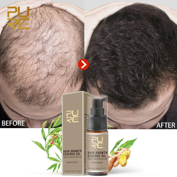 Hair Growth Essential Oils Spray Products Anti Hair Loss Serum Treatment Dry Hair Thinning Frizzy Split Scalp Health Care Oil